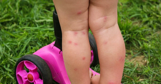 Grasmilben erkennen: Typische Anzeichen im Garten